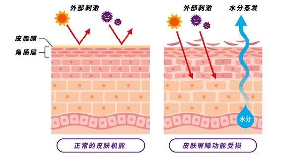 有哪些低成本改善皮肤粗糙的方法 护肤小知识 护肤方法 皮肤粗糙 第1张 有哪些低成本改善皮肤粗糙的方法 护肤小知识 护肤方法 皮肤粗糙 第1张