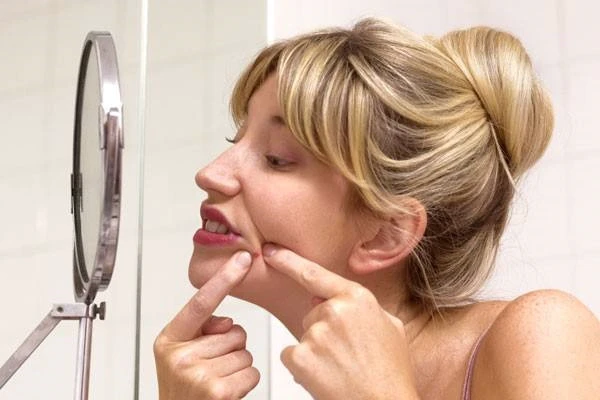 天气热的时候脸上就会长出痘痘，原因是什么 痤疮 第2张