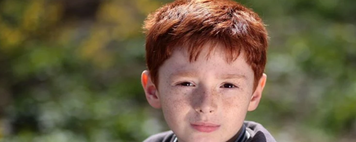 头发稀疏怎么办 头发稀疏 美妆 第1张