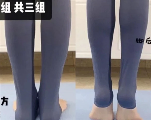轻松改变小腿外翻瘦出筷子腿！如何判断小腿肌类型 筷子腿 小腿外翻 第5张