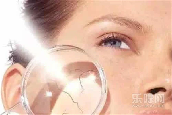 眼角纹是怎么形成的 护肤 第5张