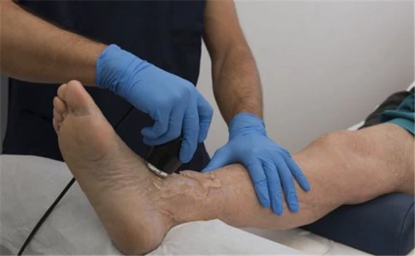 腿部吸脂手术有哪些优势,腿部吸脂后想要快速消肿 腿部 优势 第2张 腿部吸脂手术有哪些优势,腿部吸脂后想要快速消肿 腿部 优势 第2张