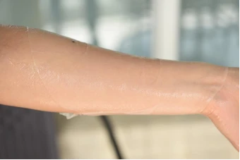 让人白到发光的MFA面膜，熬夜必备，15分钟让你彻底爱上敷面膜 面膜 MFA面膜 护肤 第4张