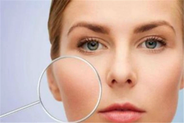 油脂分泌旺盛导致毛孔粗大，定期去角质改善控油 油脂 毛孔 第3张