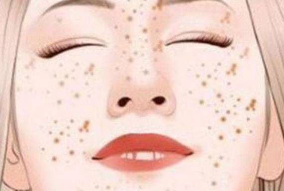 祛雀斑方法有哪些 祛雀斑 祛雀斑方法 美妆 第1张