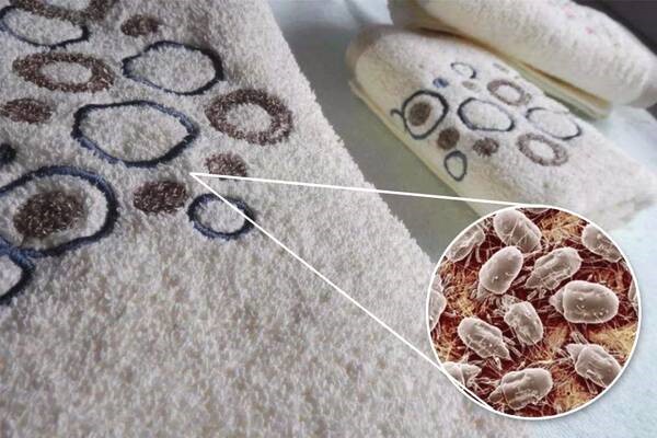 怎么去黑头，去黑头的几个方法分享 黑头 第1张