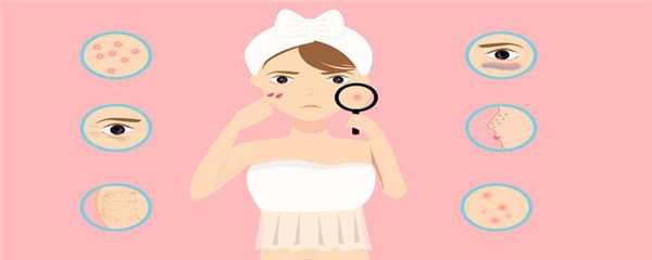 长痘的人能吃巧克力蛋糕吗，长痘的人不能吃什么 护肤 第1张