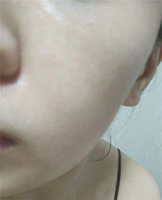 修丽可紫米精华成分,修丽可紫米精华使用测评 精华 修可丽 第5张 修丽可紫米精华成分,修丽可紫米精华使用测评 精华 修可丽 第5张