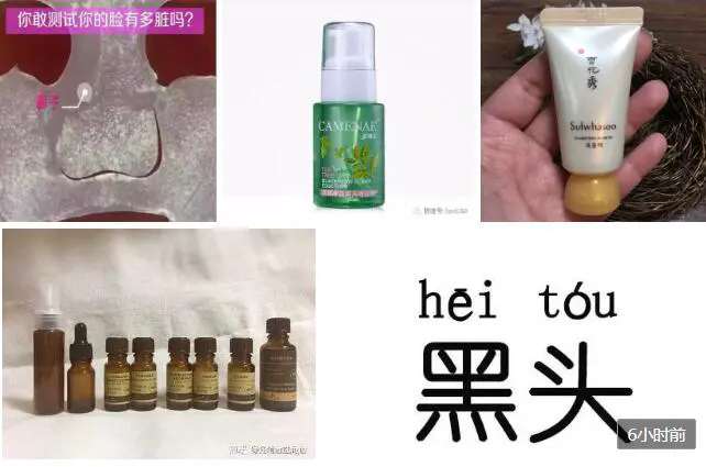 黑头是怎么来的，该怎样解决黑头 黑头 美容 第3张