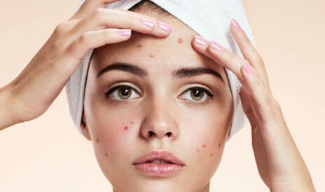 平时应该如何预防鼻子长痘，要以注意清洁力度 预防 鼻子 第1张