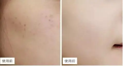 传承国民养肤经典，片仔癀白金级珍珠膏打造时光御藏的美人 护肤 片仔癀 片仔癀白金级珍珠膏 美容 第4张