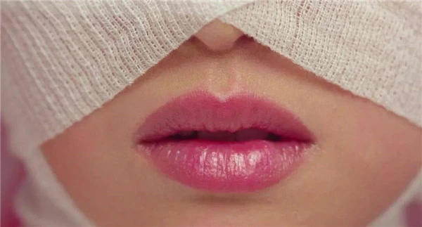 昊海生科玻尿酸打开医美市场，轻松收割美丽 昊海生科 玻尿酸 第2张