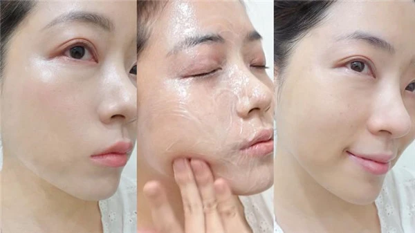 长时间戴口罩狂冒粉刺、长痘痘怎么办，酵素洗颜粉新品推荐 粉刺 酵素洗颜粉 第5张