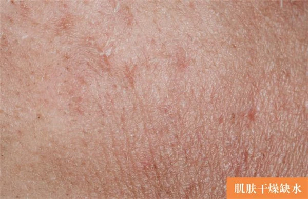 油性肌肤适合哪款精华液，不含油脂的精华液不含油脂的精华液 油性肌肤 精华液 第7张