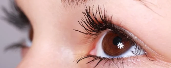 怎样去除脂肪粒 去除脂肪粒 美妆 第3张