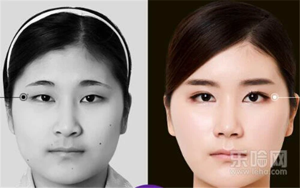 割双眼皮多少钱 护肤 第3张