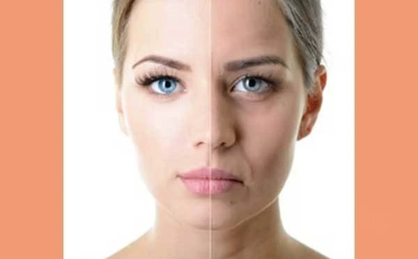 法令纹形成的原因，预防法令纹的方式方法 法令纹 预防 第5张