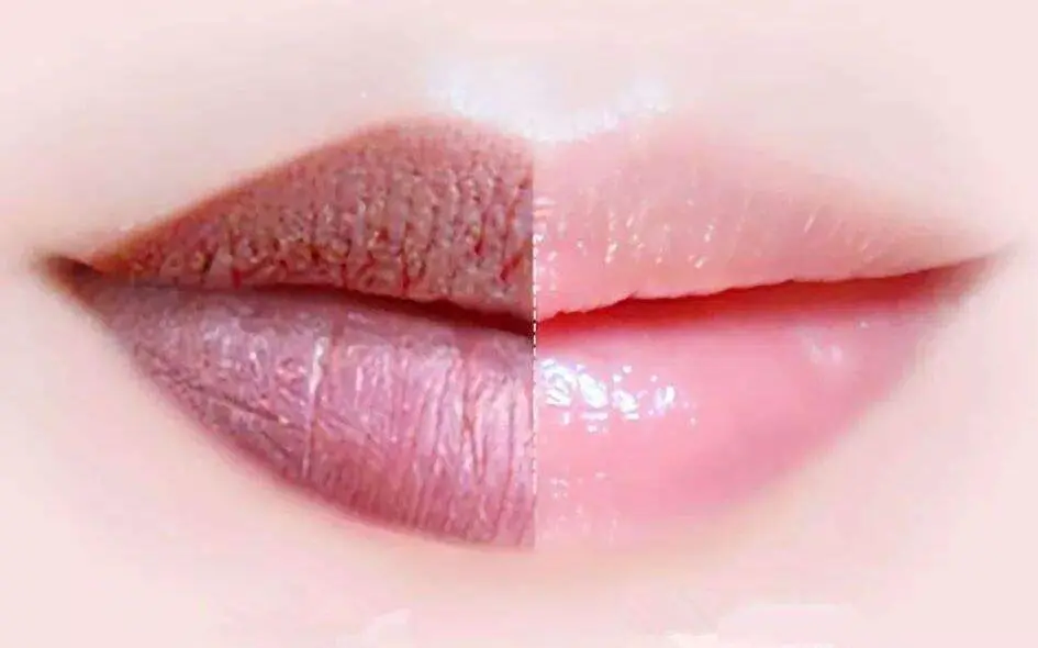 唇纹深怎么办,盘点消除唇纹深的方法 唇纹深 唇纹深怎么办 盘点消除唇纹深的方法 美妆 第3张 唇纹深怎么办,盘点消除唇纹深的方法 唇纹深 唇纹深怎么办 盘点消除唇纹深的方法 美妆 第3张