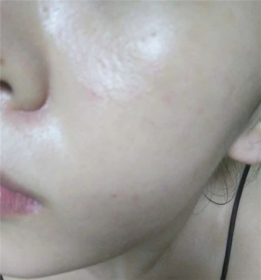 修丽可紫米精华成分,修丽可紫米精华使用测评 精华 修可丽 第4张 修丽可紫米精华成分,修丽可紫米精华使用测评 精华 修可丽 第4张