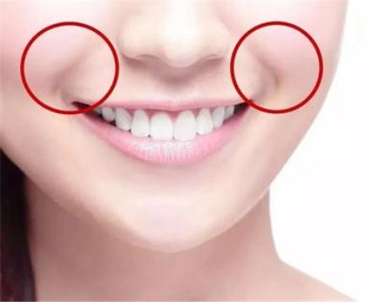 打完法令纹晚上疼一晚怎么回事 法令纹 玻尿酸 美妆 第1张