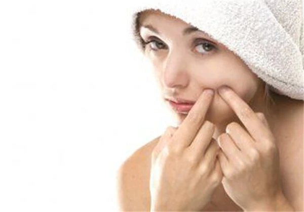 挤痘痘挤出来的是什么 护肤 第5张