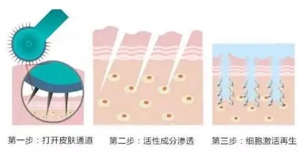 想要恢复原始美肌，靠伊肤泉微针就够了，深层补充肌肤营养 美肌 伊肤泉微针 第1张