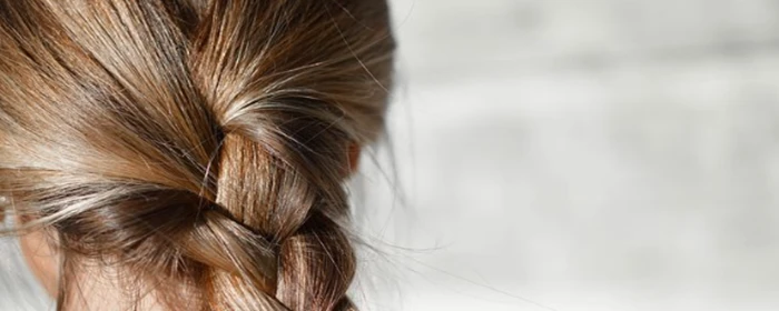 头发稀疏怎么办 头发稀疏 美妆 第2张