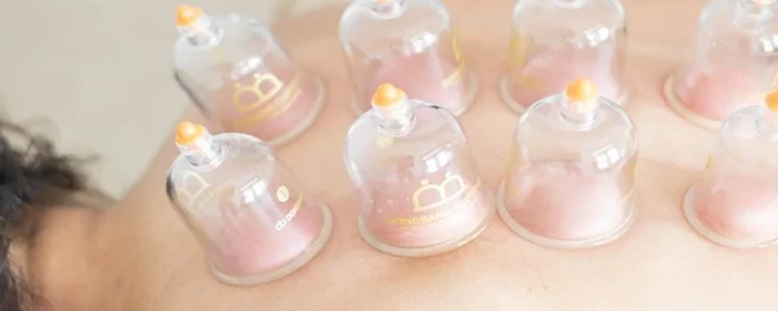 拔罐减肥反弹吗 拔罐减肥 美妆 第2张 拔罐减肥反弹吗 拔罐减肥 美妆 第2张