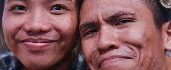 白头粉刺怎么去除 白头 粉刺 美妆 第2张