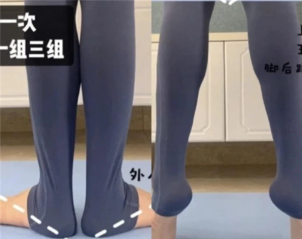 轻松改变小腿外翻瘦出筷子腿！如何判断小腿肌类型 筷子腿 小腿外翻 第7张