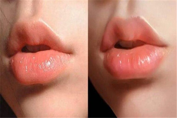 嘴唇太厚应该如何改变,经常舔嘴唇会造成唇部脱皮 嘴唇 脱皮 第1张 嘴唇太厚应该如何改变,经常舔嘴唇会造成唇部脱皮 嘴唇 脱皮 第1张