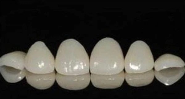 如何会拥有美白亮丽的牙齿，牙黄的美白方式有哪些 牙黄 美白 第5张