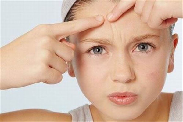 长痘是福，让痘痘告诉你身体哪出毛病了 护肤 第1张