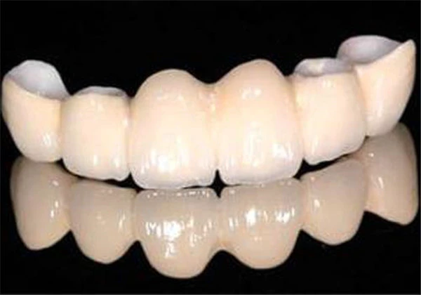 烤瓷牙可以取下来吗 护肤 第3张 烤瓷牙可以取下来吗 护肤 第3张