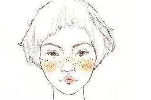 激光祛斑后有哪些不能吃的，有哪些吃的可以帮助恢复 激光 第1张