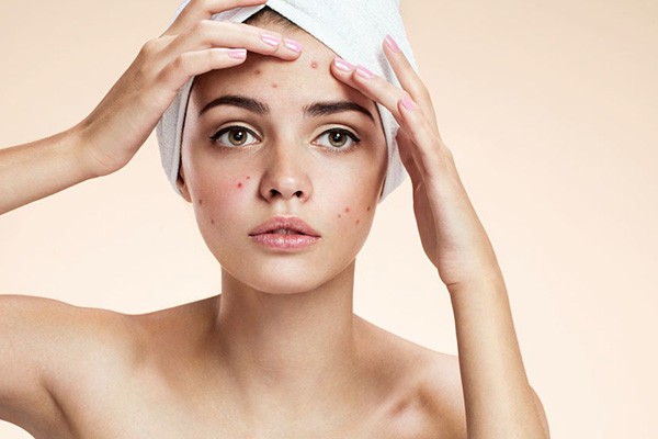 去痘可不可以使用珍珠粉 珍珠粉 第1张