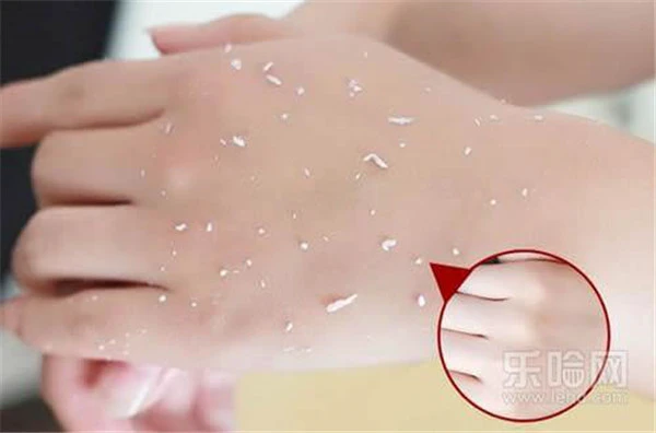 磨砂膏能去鸡皮肤吗 护肤 第3张