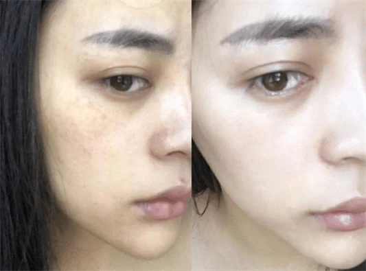 女生25岁就显老李佳琦推荐使用蜜梨面霜，让你肌肤提亮嫩白 面霜 李佳琦 第3张