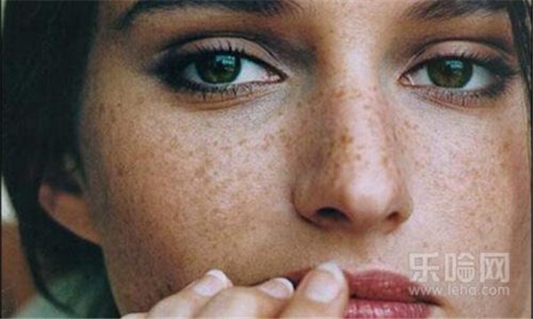 为什么女人会长黄褐斑 护肤 第1张 为什么女人会长黄褐斑 护肤 第1张