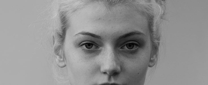 脸部油腻长痘怎么办 脸部 油腻 长痘 美妆 第3张