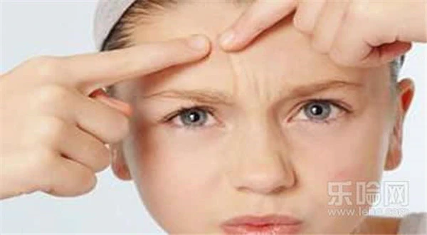 闭口粉刺可以挑吗 护肤 第4张