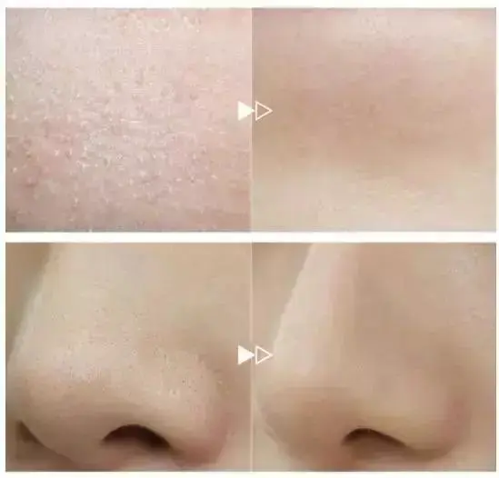 值得回购的清洁面膜有哪些 黑头 清洁 清洁面膜 美容 第12张