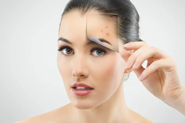 六个生活中的坏习惯是长痘痘的主要原因 肌肤 第2张