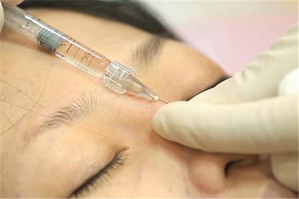 玻尿酸能抗老除皱，注射玻尿酸能调整脸型线条 玻尿酸 脸型 第1张