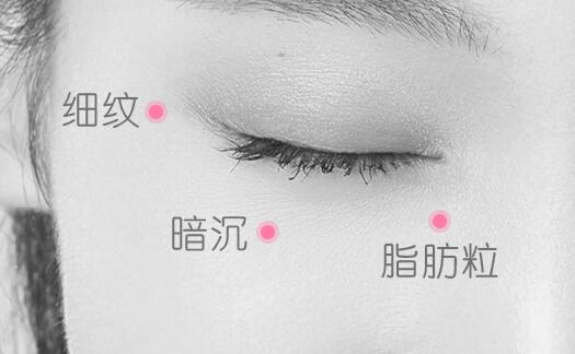 眼霜是第几步擦，眼霜正确护肤顺序 眼霜 眼霜是第几步擦 眼霜正确护肤顺序 美容 第1张