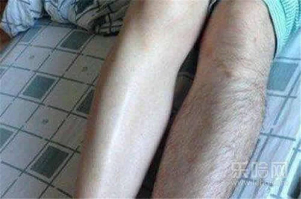 脱毛膏脱完了还会长吗 护肤 第4张