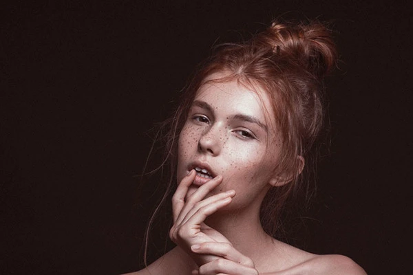 女人生完孩子为什么脸上会长斑 皮肤 第3张