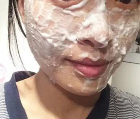 阿莫西林真的可以去黑头吗 黑头 阿莫西林 美妆 第2张