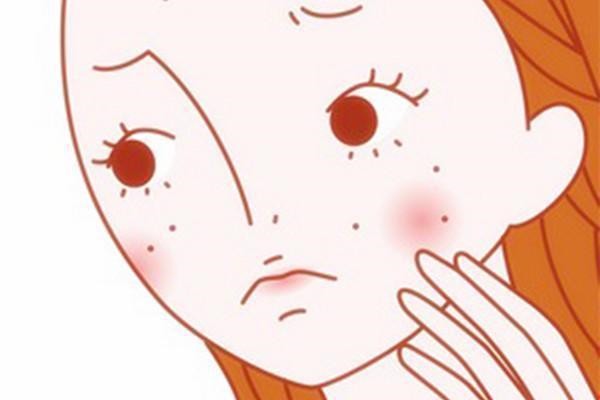 起痤疮的原因是什么，痤疮是怎么长出来的 痤疮 第1张