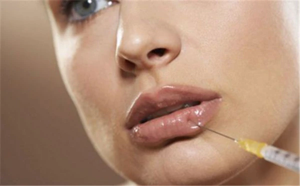 唇珠成形术的注意哪些事项,唇珠成形术的过程 唇珠 成形术 第2张 唇珠成形术的注意哪些事项,唇珠成形术的过程 唇珠 成形术 第2张